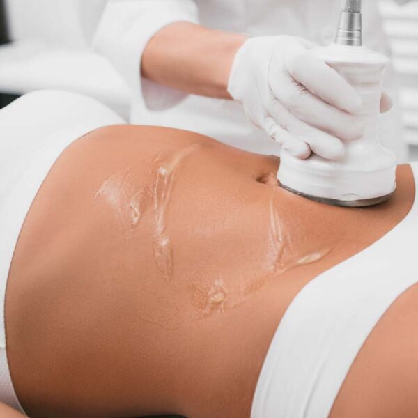 Fat Reduction Cavitation