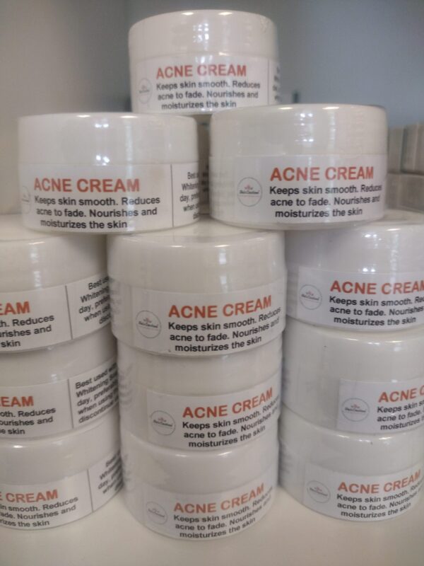 Acne Cream